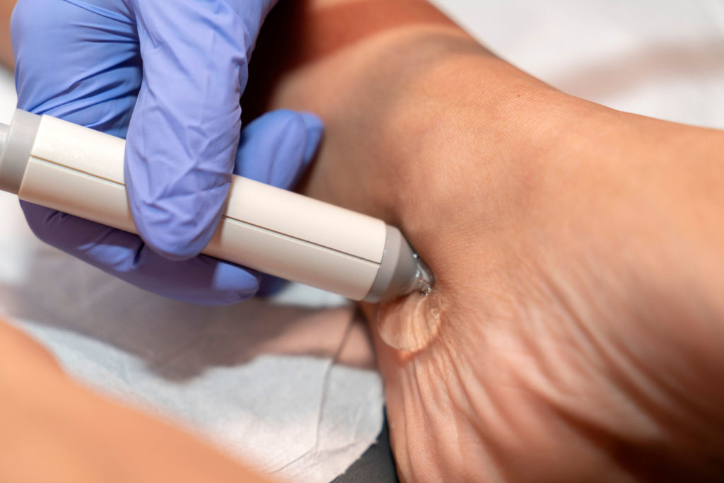 Blood pressure measurement from the popliteal artery leg, Ankle Brachial Index, Cardio‐ankle vascular index, tibial pulse