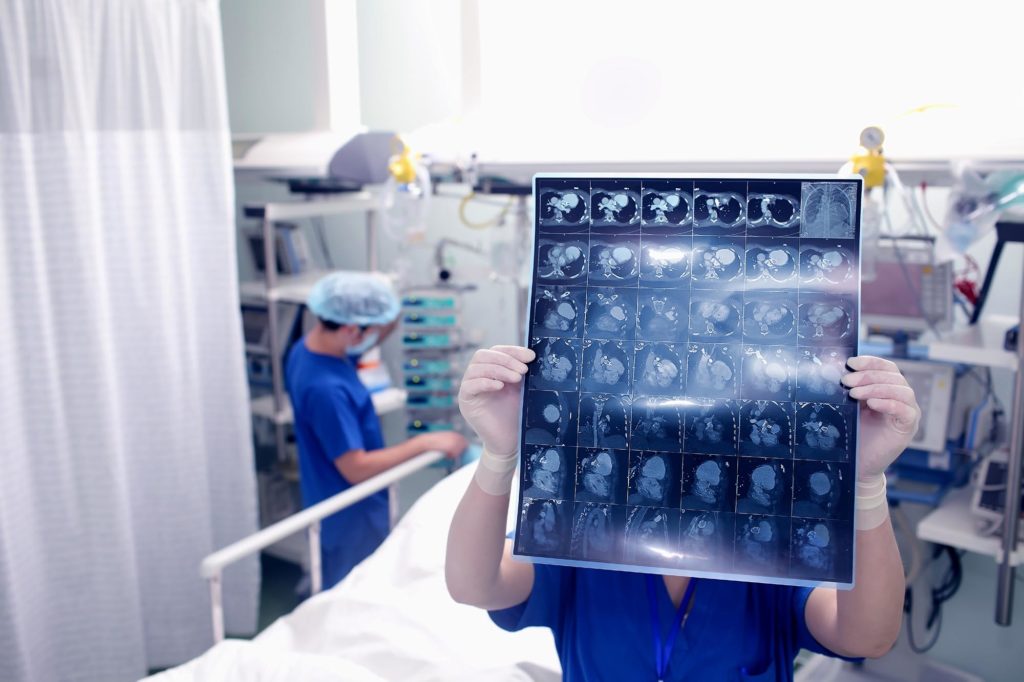 Doctor examines the patient's CT scan in a hospital ward